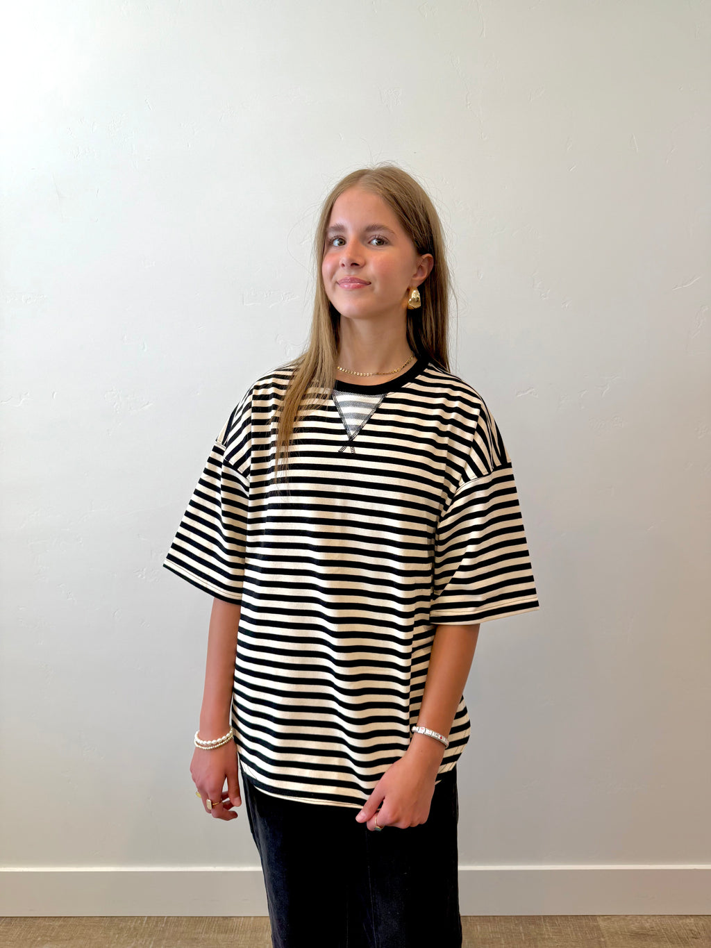 Millie Striped Oversized Top