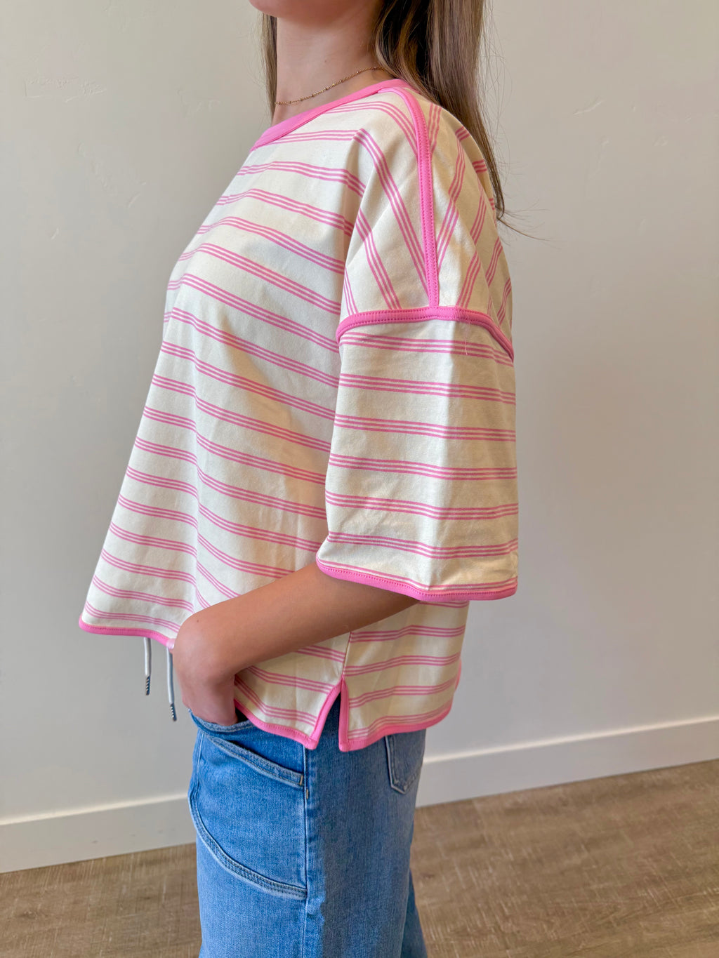 Sunny Striped Oversized Top