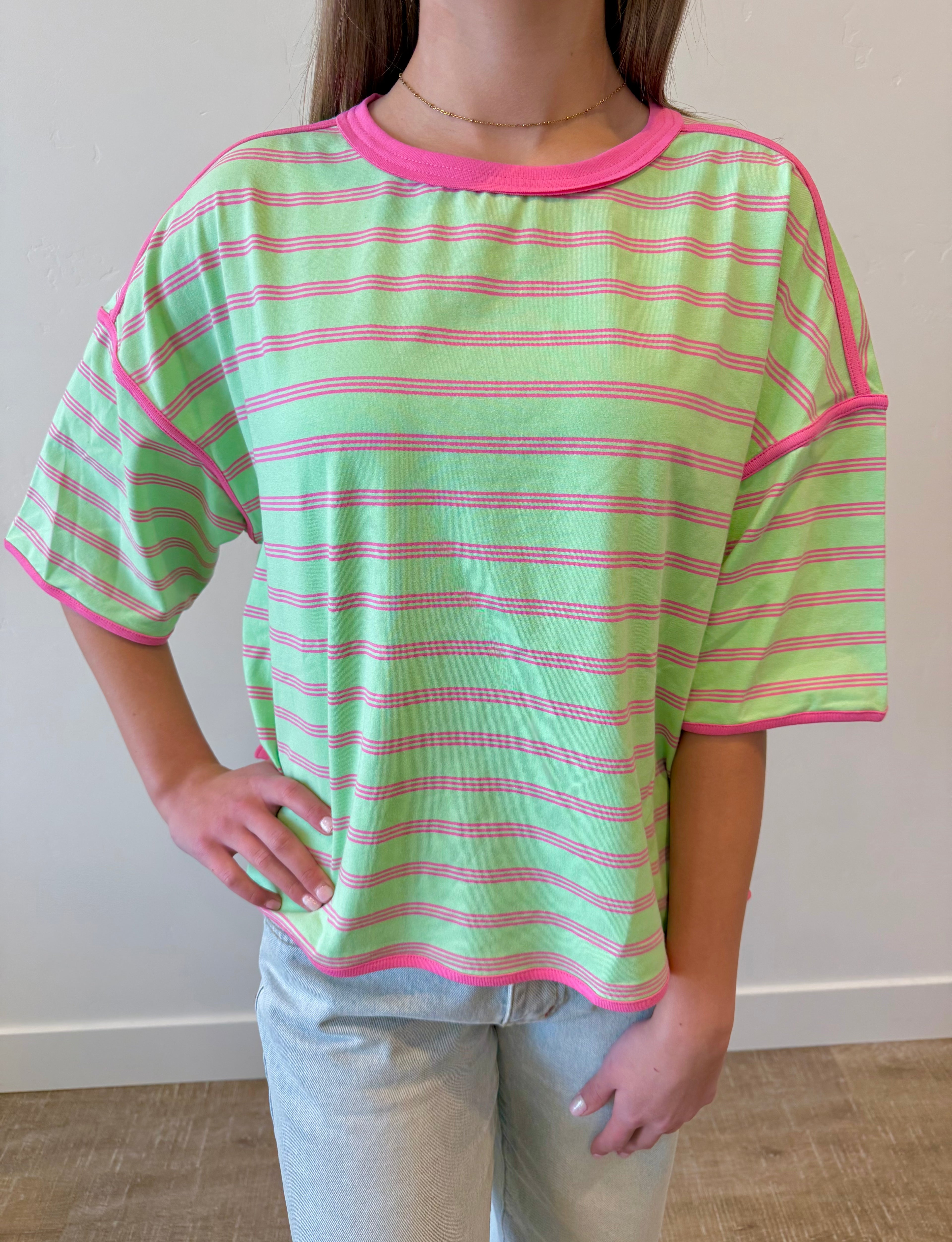 Sunny Striped Oversized Top