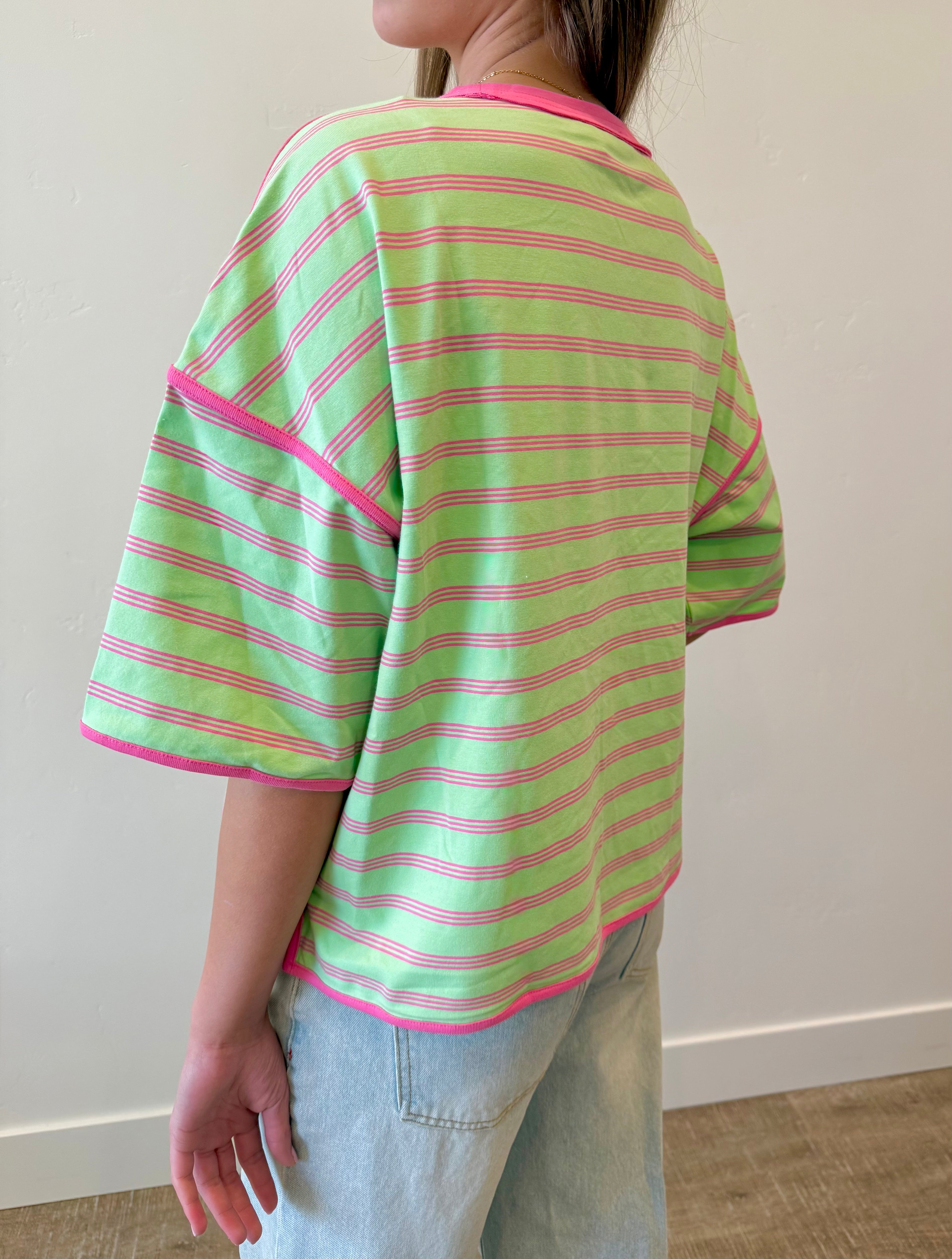 Sunny Striped Oversized Top