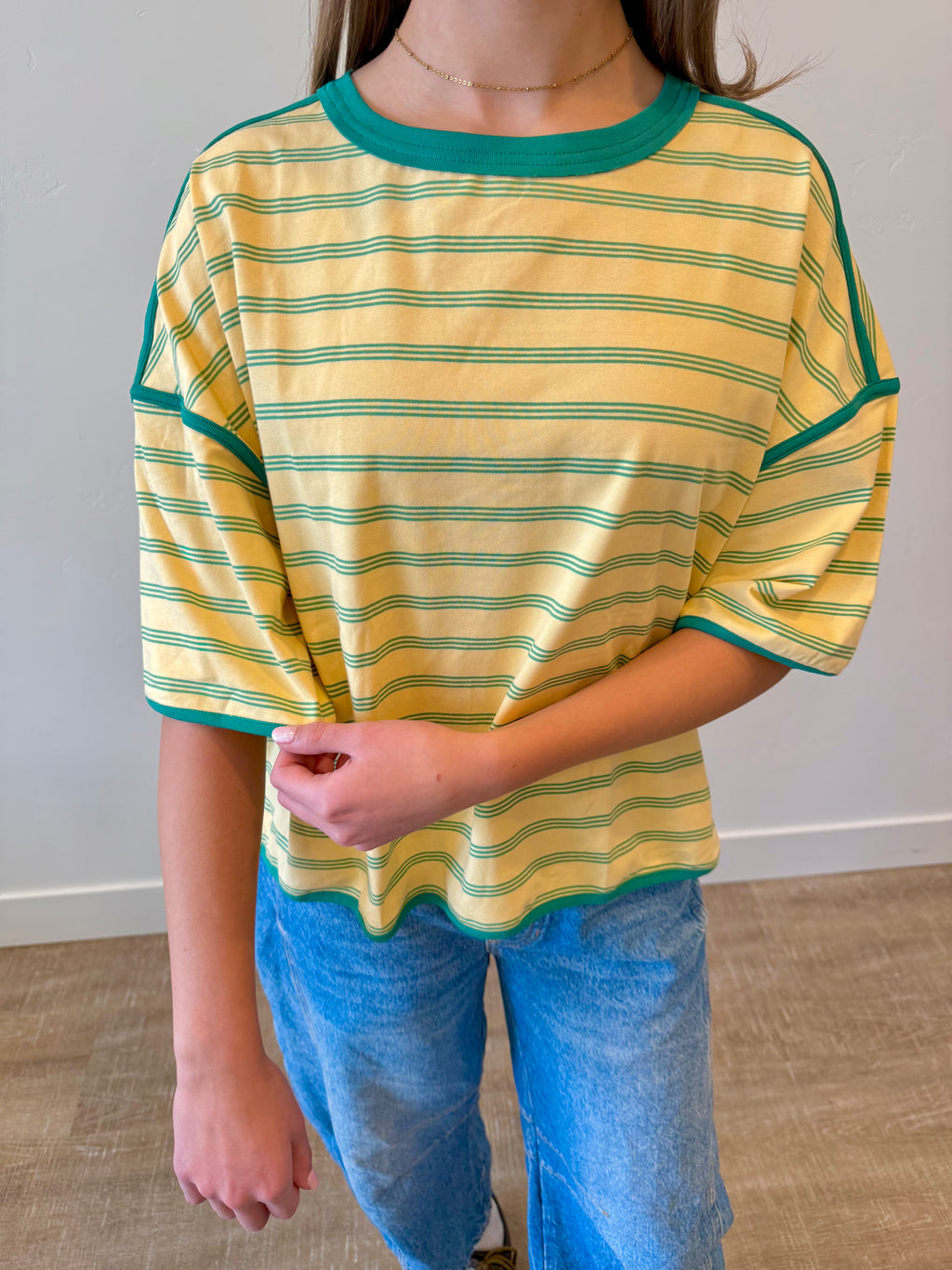 Sunny Striped Oversized Top