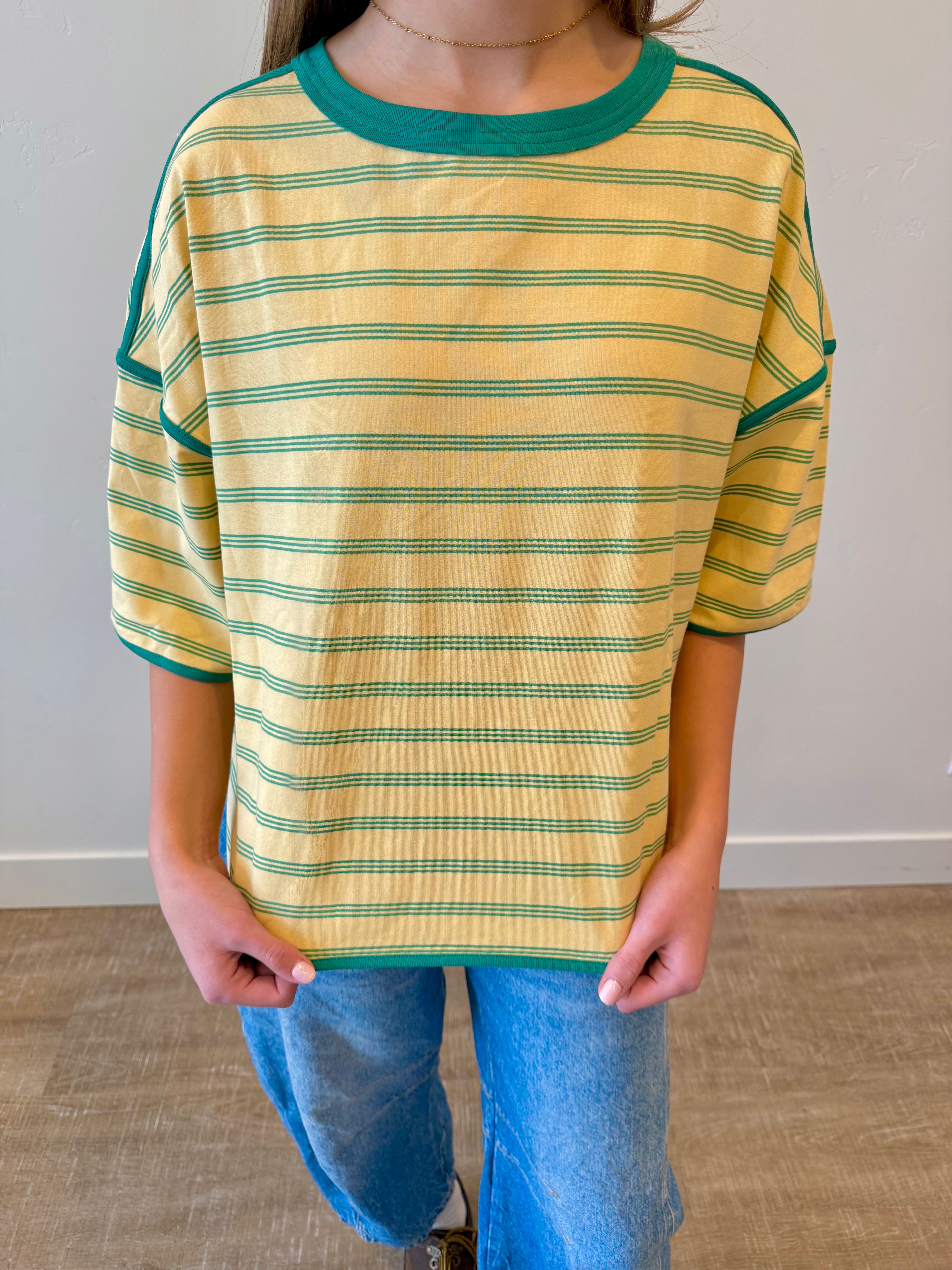 Sunny Striped Oversized Top