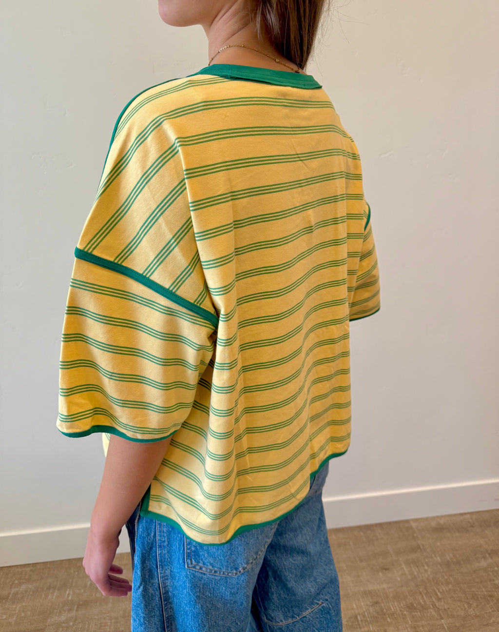 Sunny Striped Oversized Top