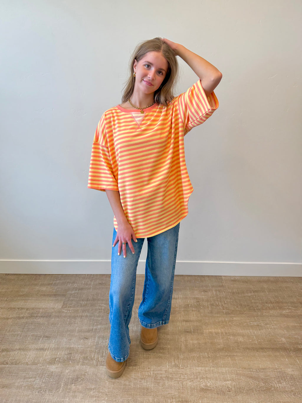 Millie Striped Oversized Top