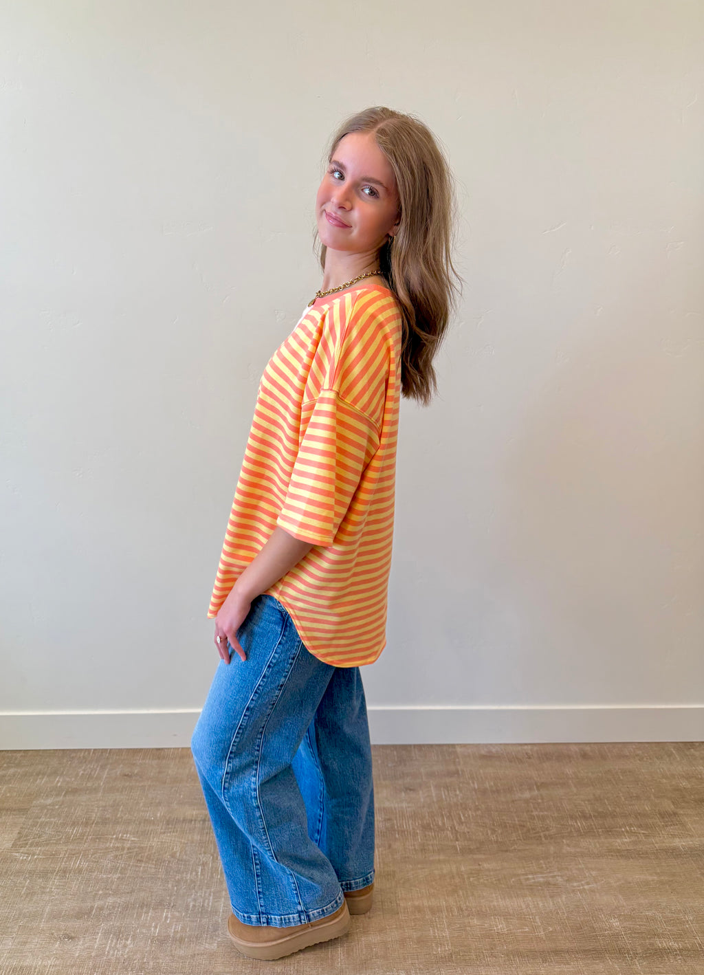 Millie Striped Oversized Top