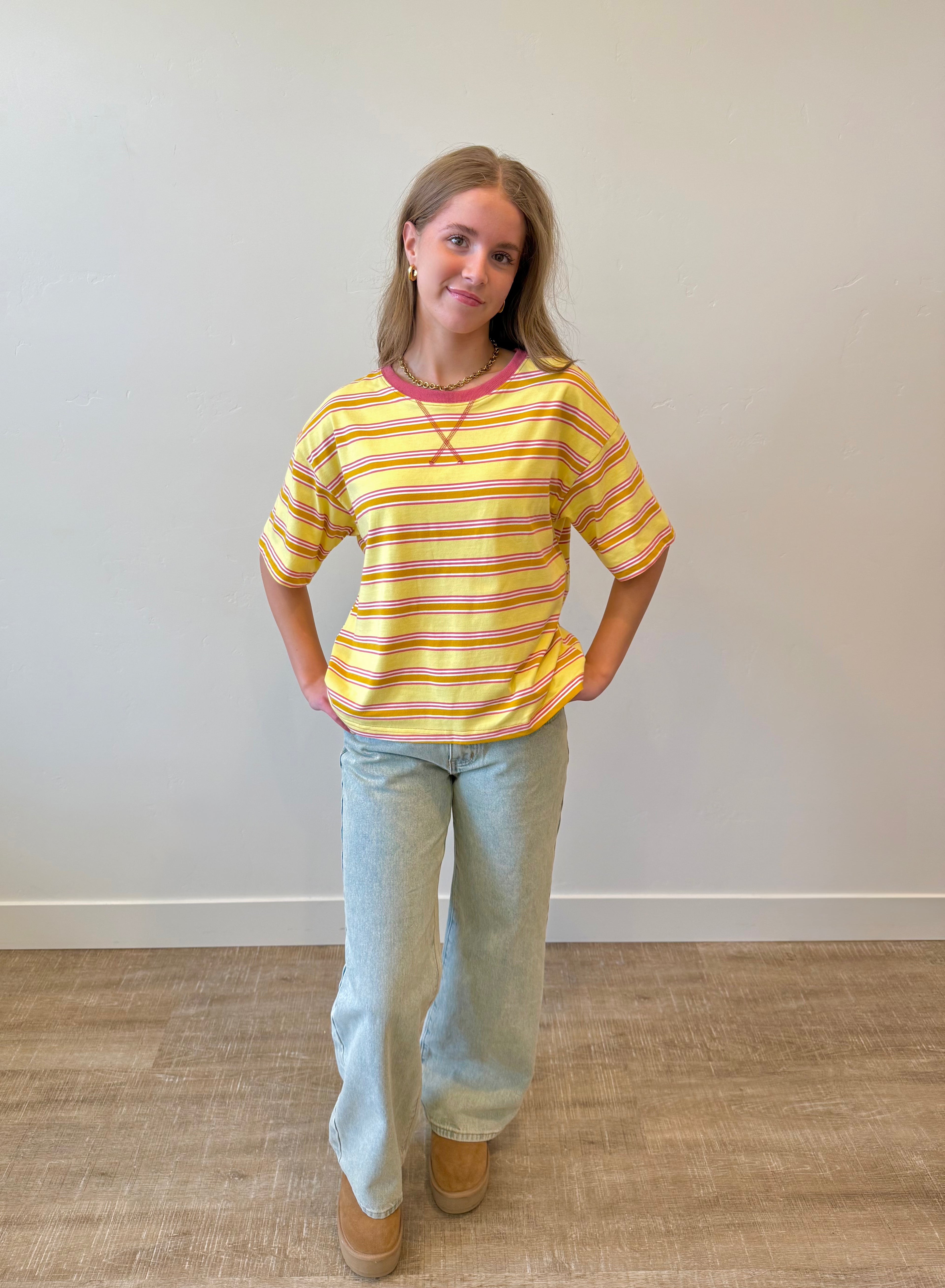 Skye Striped Oversized Top